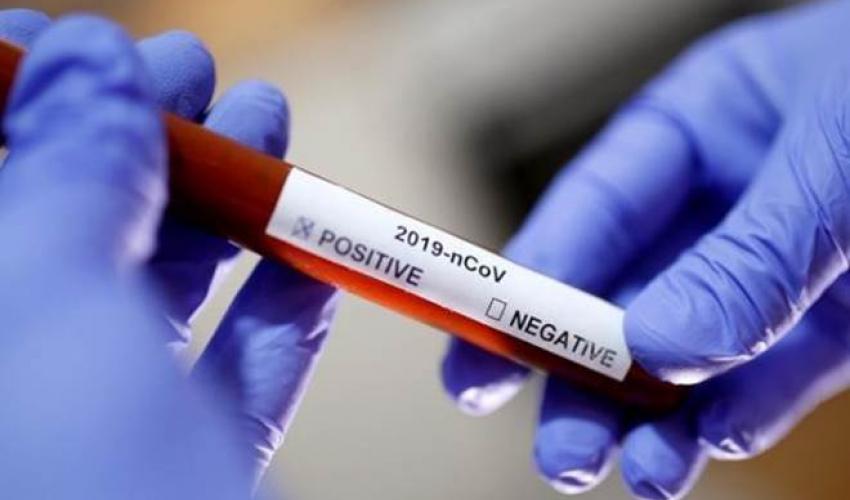 क्वारेन्टिनमा आत्महत्या गरेका अछामका युवकको कोरोना रिपोर्ट पोजेटिभ